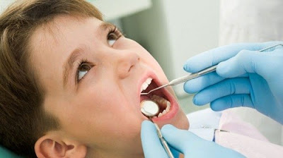 Trẻ em có nên hàn răng không?