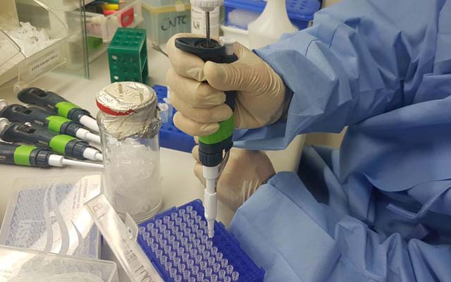 Fiocruz desenvolve teste para Zika mais barato e rápido