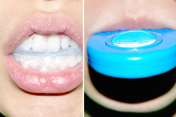 How to Use Smile Brilliant LED Whitening Kit