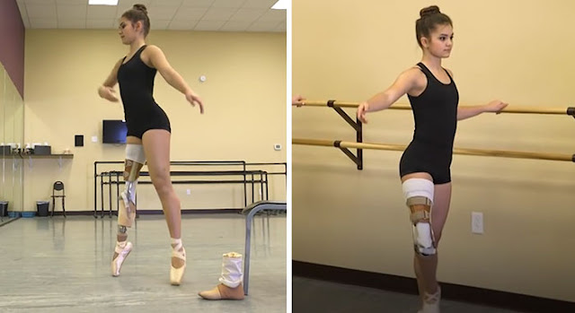Proklitiko.gr - 15χρονη μπαλαρίνα που έχασε το πόδι της από καρκίνο σήμερα χορεύει ξανά! (Εικόνες & Βίντεο)