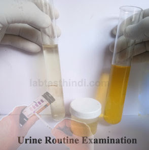 Urine Routine  Examination