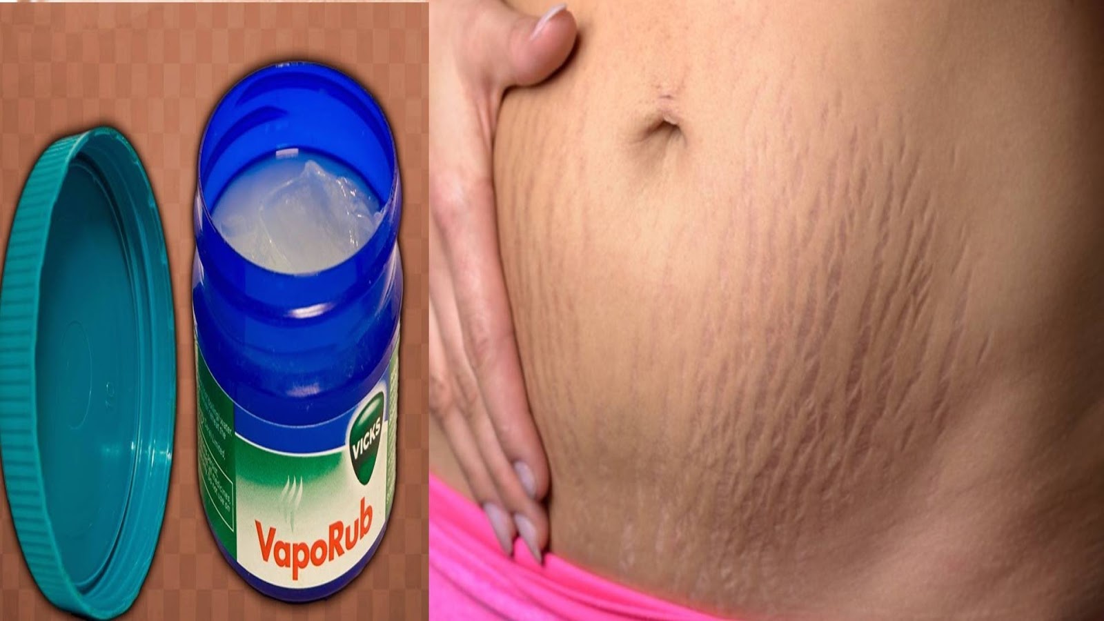 como usar el vick vaporub para reducir abdomen