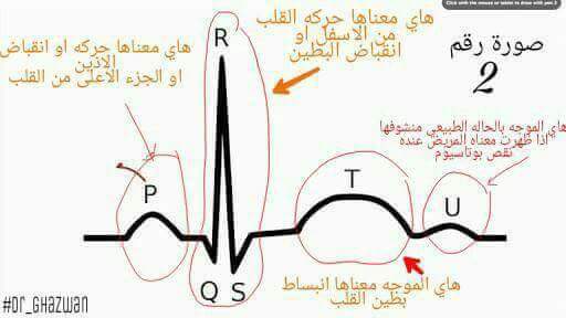 تعلم معنا ؟ كيف تقرا تخطيط القلب ECG