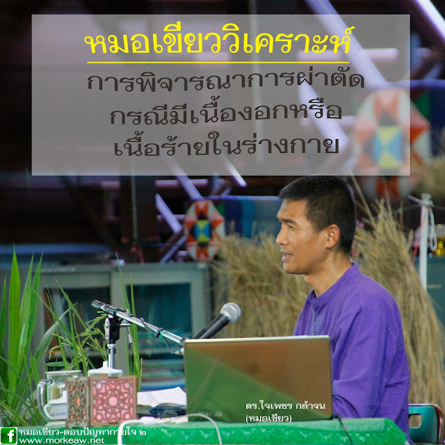 My Image 30