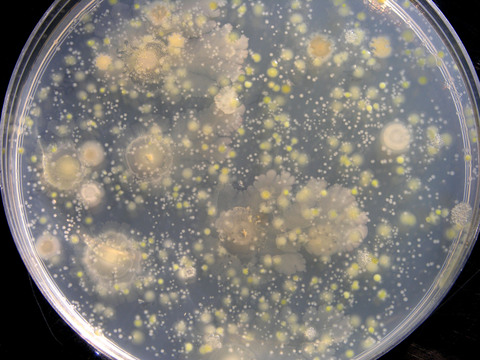 petri-dish-w-bacteria.jpg