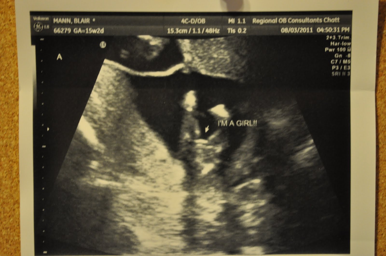 15 неделя 2023. 15 Недель беременности. 15 Недель беременности как выглядит. 15 Неделя беременности малыш на руке фото.