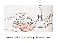 Metode inokulasi Bakteri Metode inokulasi Bakteri