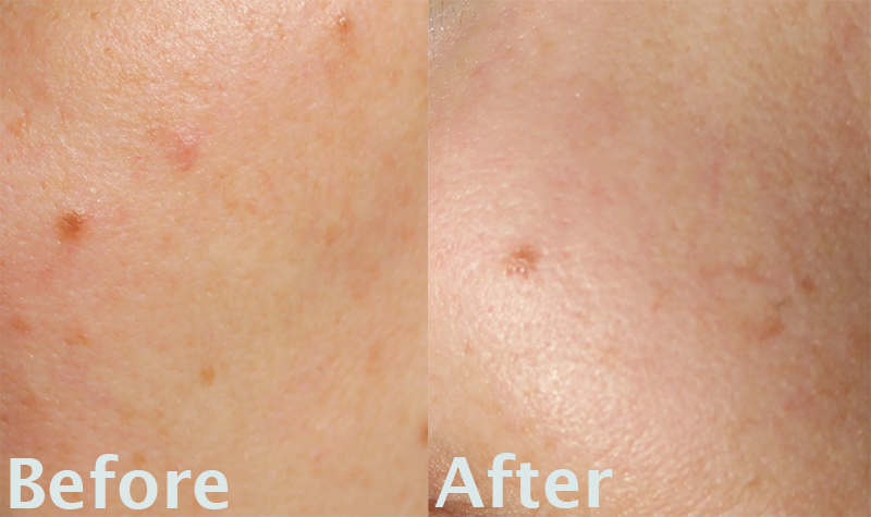 eucerin even brighter day cream