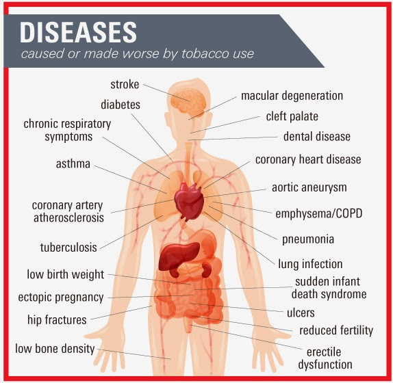 Smoking disease. заболевания бронхолегочной системы. Smoking disease. Smoking disease. Smoking disease.