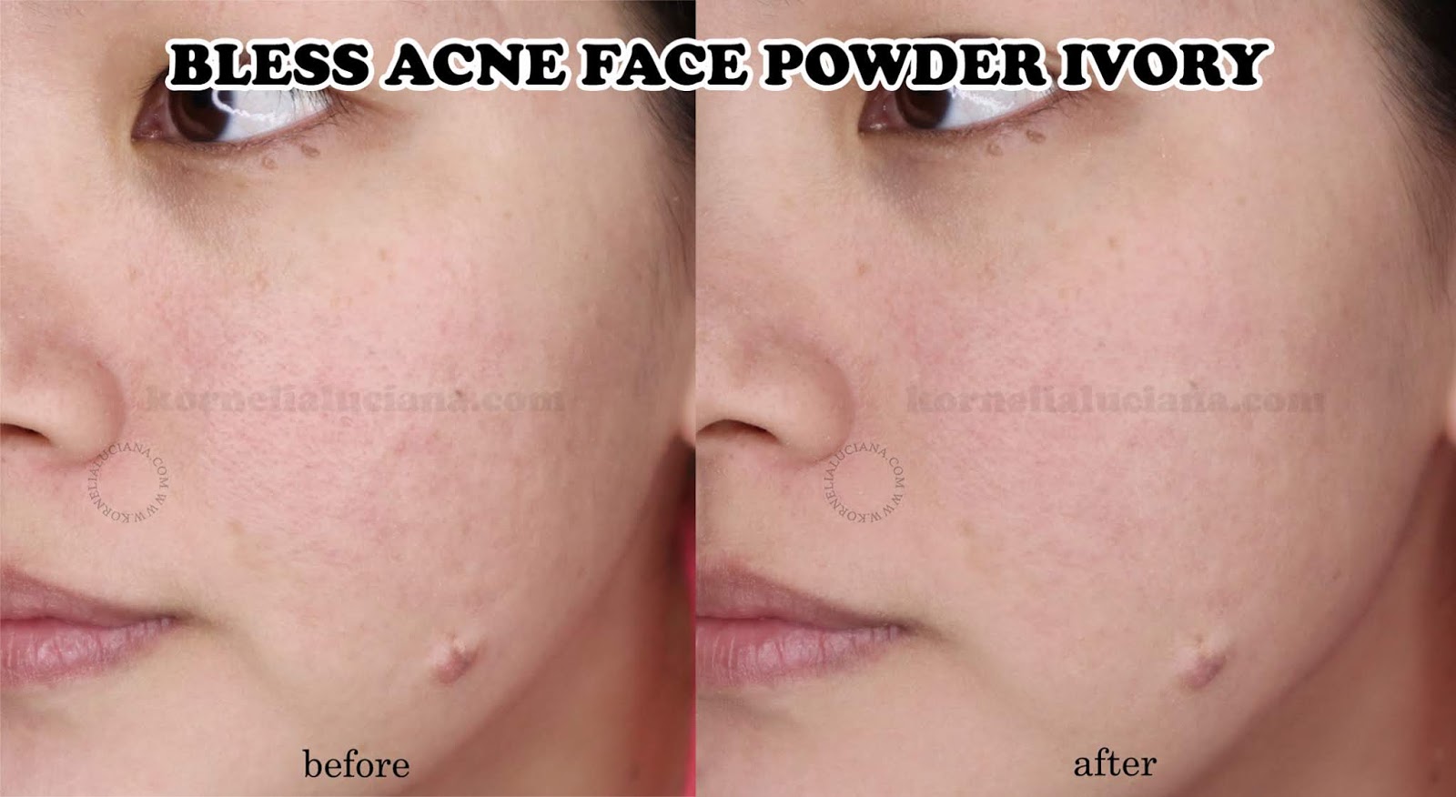 bless acne liquid foundation