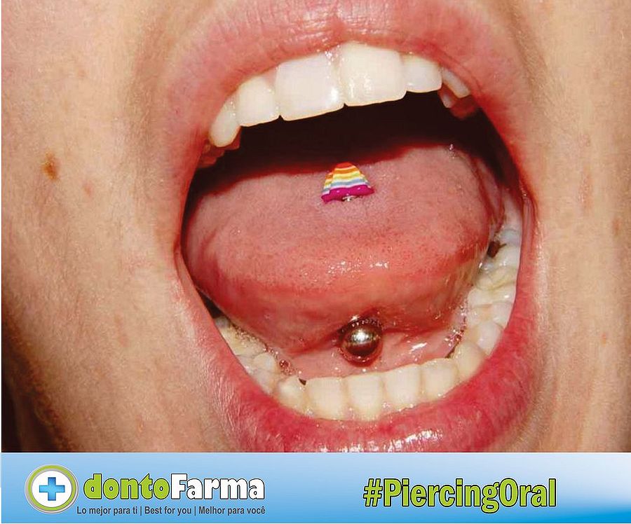 consecuencias de usar piercing en la lengua consecuencias de usar piercing en la lengua