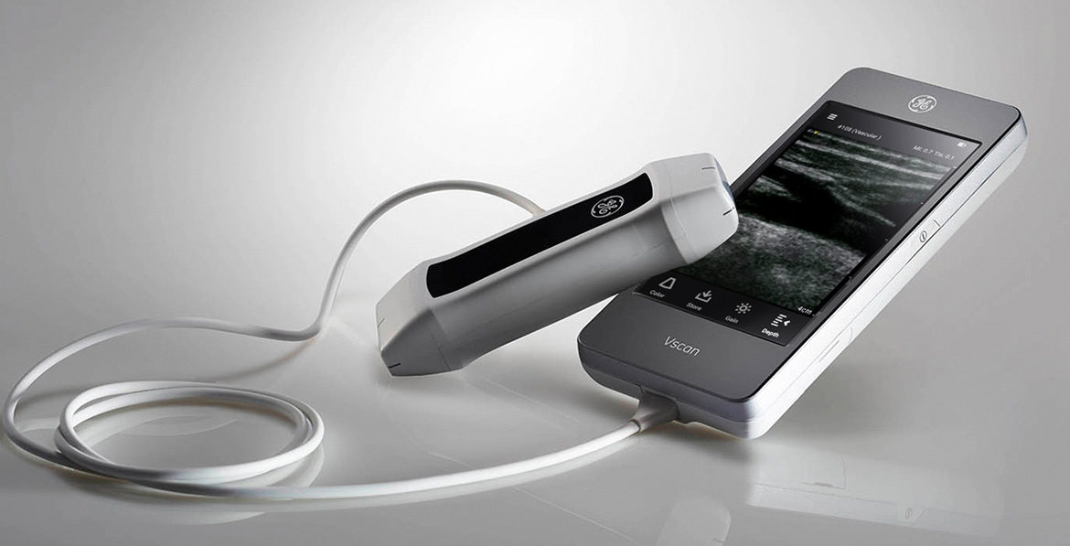 Ob/Gyn Updated GE releases new portable compact ultrasound The Vscan