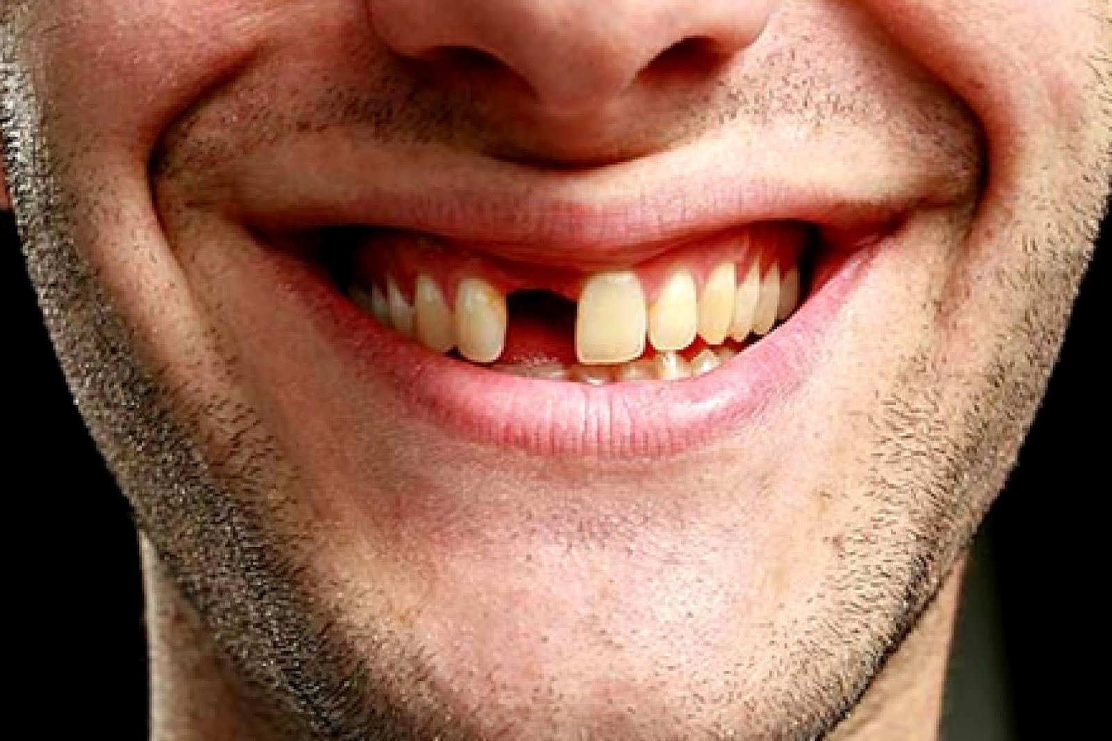 ИСПАНСКИЕ ЗАМЕТКИ Los Dientes