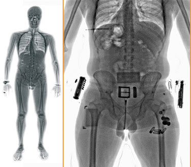 Technologies About Full Body Scanners | TECH WORLD
