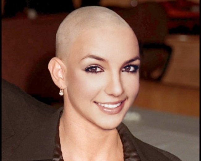 Bald Women 76