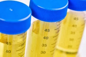 pengaruh narkoba darah urine menghilangkan tuntas hilangkan