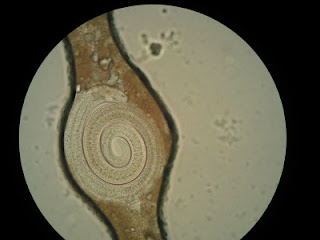 Trihinela pod mikroskopom - Trihineloza Panvet blog