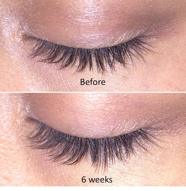 Thicker, Fuller Lashes with Zoria Boost Lash Intensifying Serum