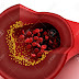 8 Foods To Help Prevent Clogged Arteries