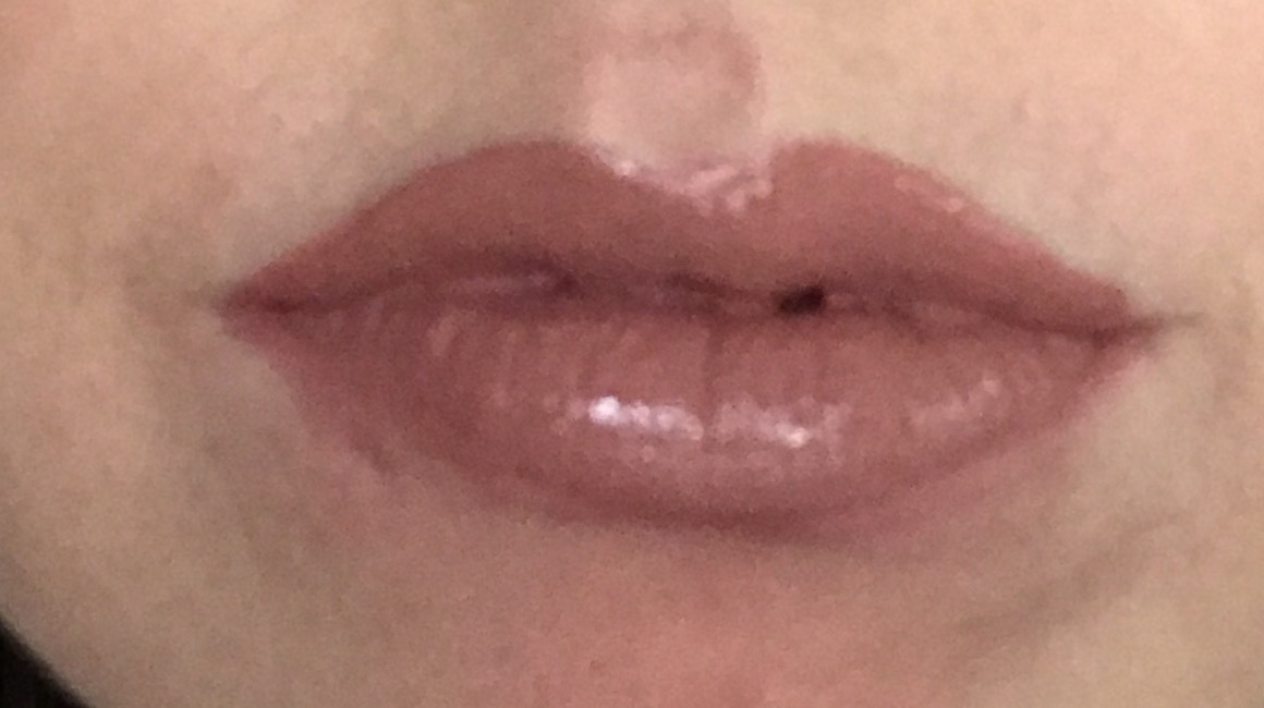 девушка с перчиком. красные губы при температуре. гранулематозный хейлит мишера. красные губы при температуре. красные губы при температуре.