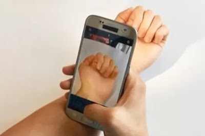 App móvil que te indica si padeces anemia con tan solo una foto de tus uñas