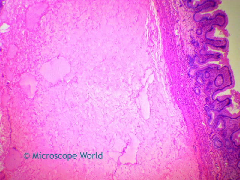 Gallbladder captured under a biological microscope at 40x