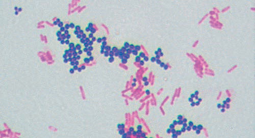 metodo coloração bacterias gram negativo positivo
