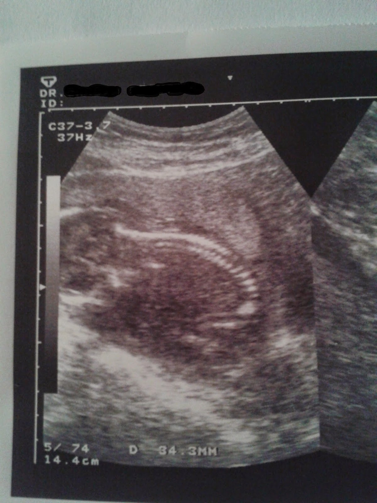 El Rincon De Marttita Bruno Y Su Columna Vertebral