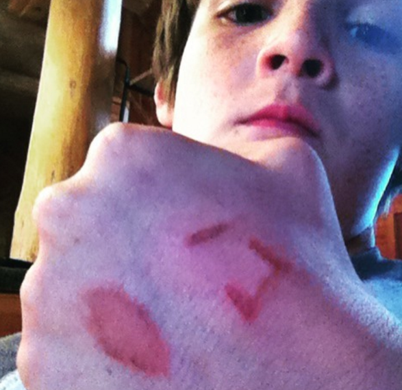 Check out the dangerous 'Eraser Challenge' kids are trying out on