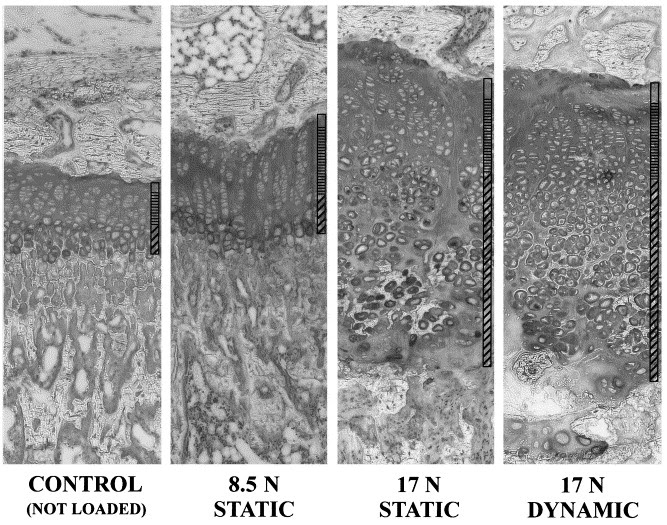 The Quest for Height Grow Taller Increase Height Bone Size