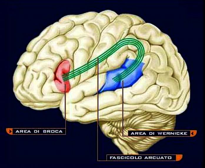 Area Di Broca E Di Wernicke Afasia di wernicke