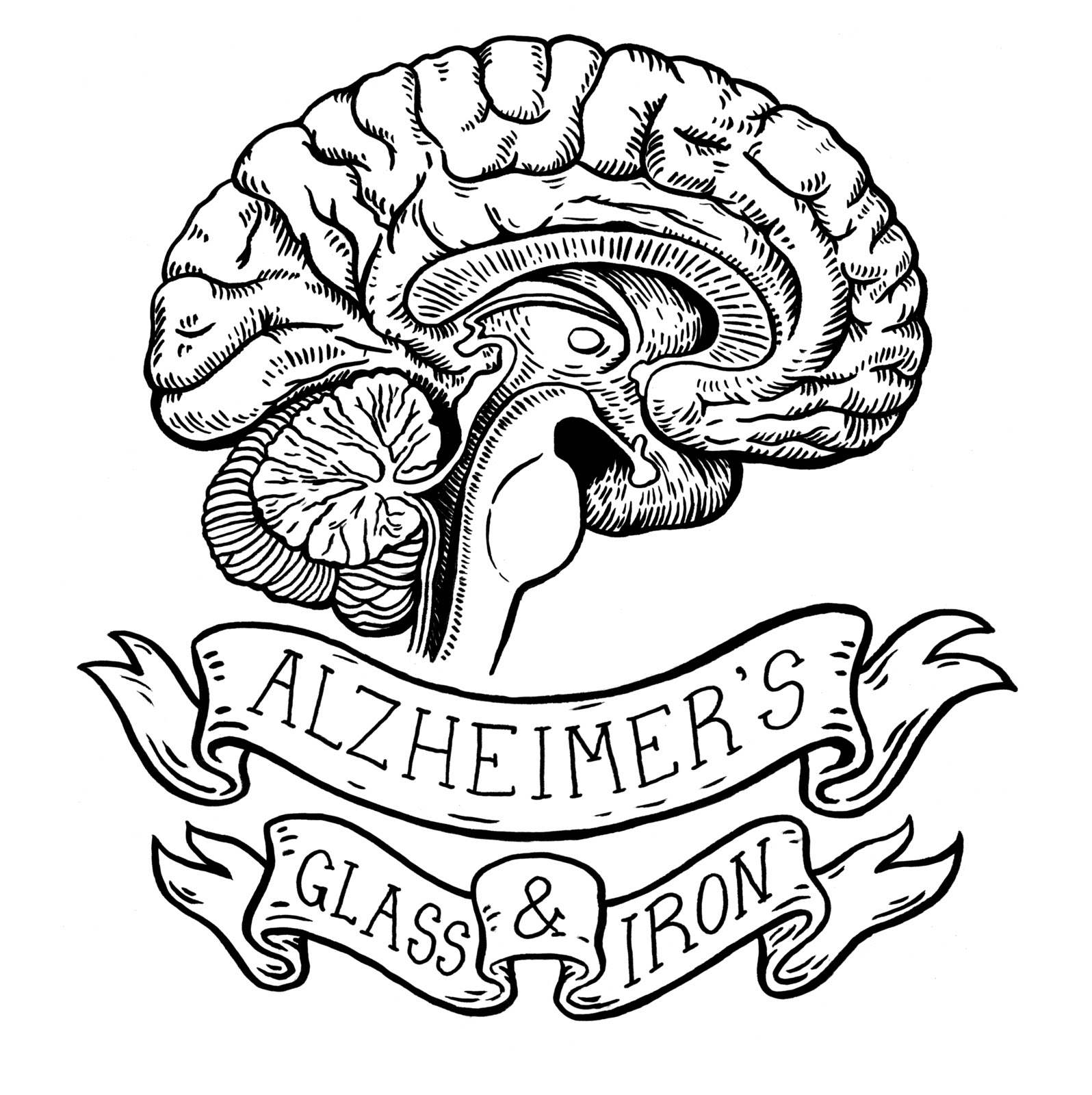 Alzheimer's Glass and Iron