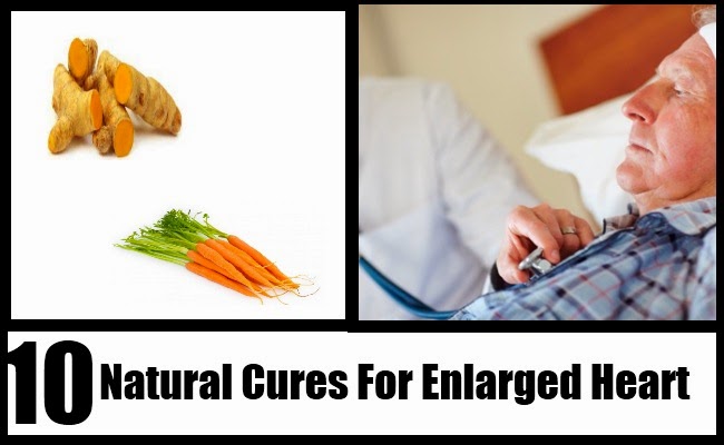 Top 10 Natural Cures For Enlarged Heart Mzizi Mkavu