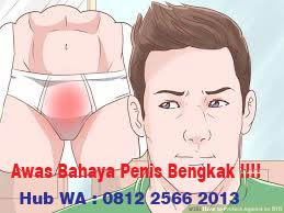 obat penis bengkak di apotik umum resep dokter