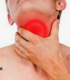 Mengobati Radang Tenggorokan Mengobati Radang Tenggorokan