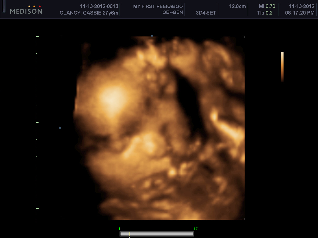 California Clancys 28 weeks! 3D ultrasound!