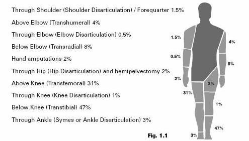 Amputation Percentages Chart