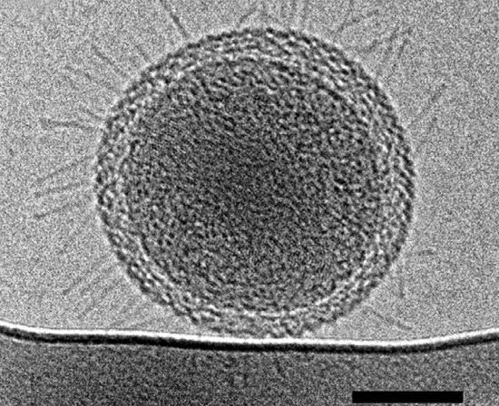 Bakteri Ultra-Kecil Dengan Volume 0,009 Mikron Kubik