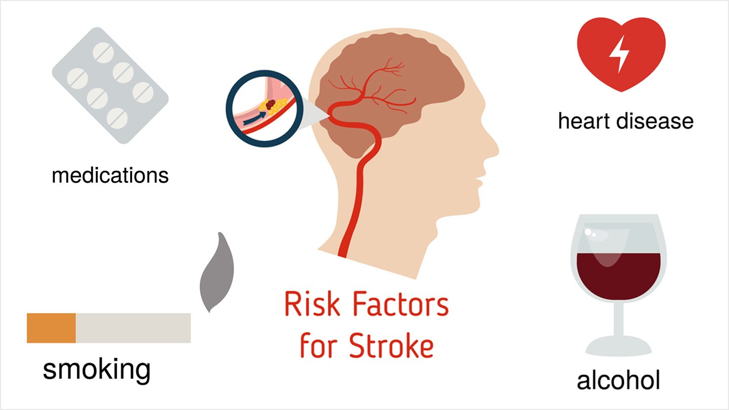 Stroke Causes and Risk Factors picture Stroke Causes and Risk Factors photo