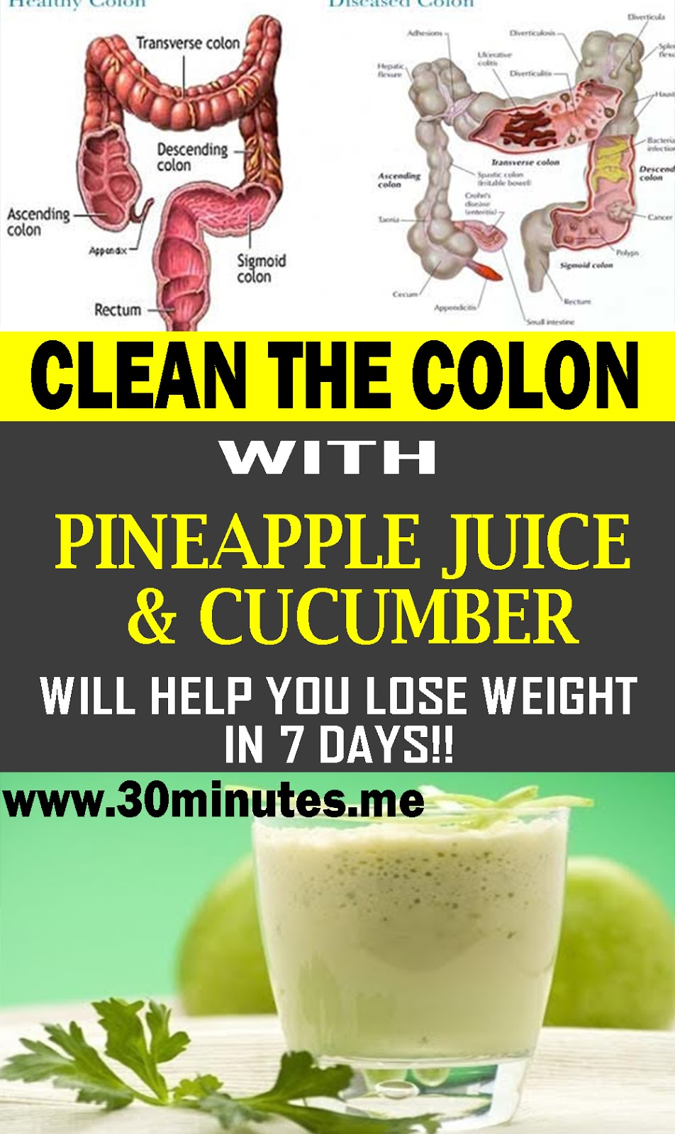 Pineapple Juice And Cucumber To Clean The Colon in 7 Days And Help You