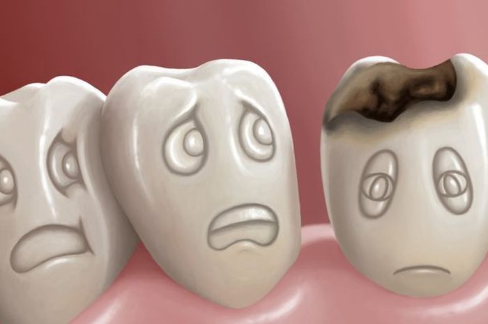 cara mengobati sakit gigi berlubang yang tak kunjung sembuh