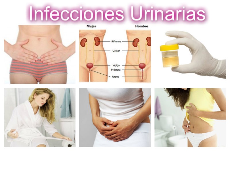 Infección urinaria
