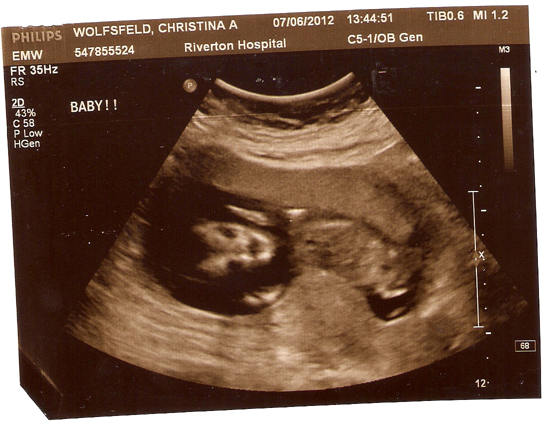14 недель отзывы. Беременность в 14. 14 Недель беременности фото.