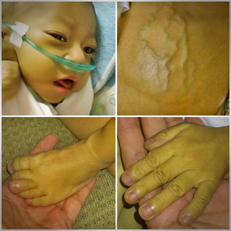 A Matter of life and Breath