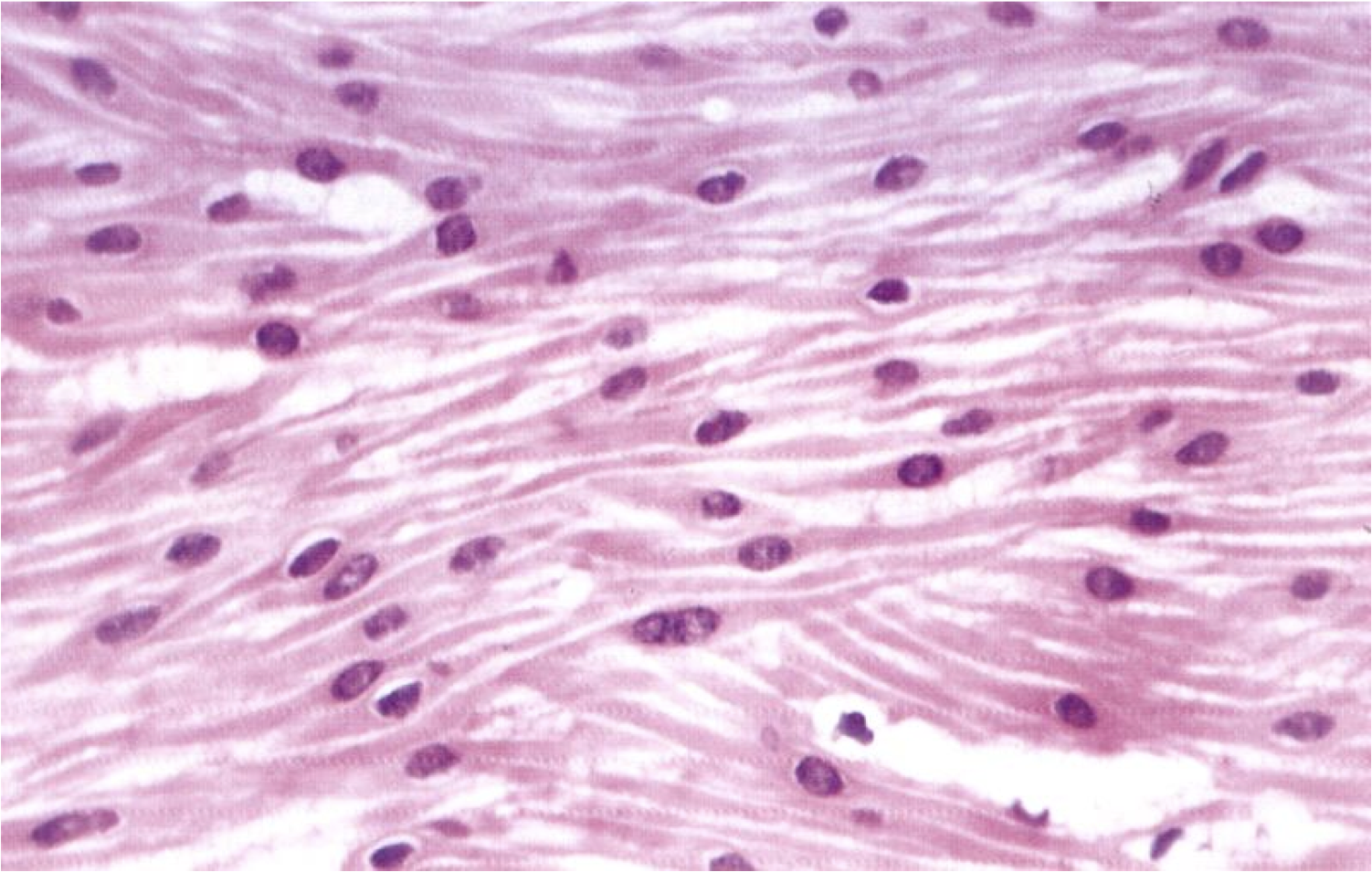 Состоят из многоядерных веретеновидных клеток. Миоциты гладкой мышечной ткани. Гладкая мышечная ткань гистология препарат. Гистологический препарат гладкой мышечной ткани. Клетки мышечной ткани гистология.