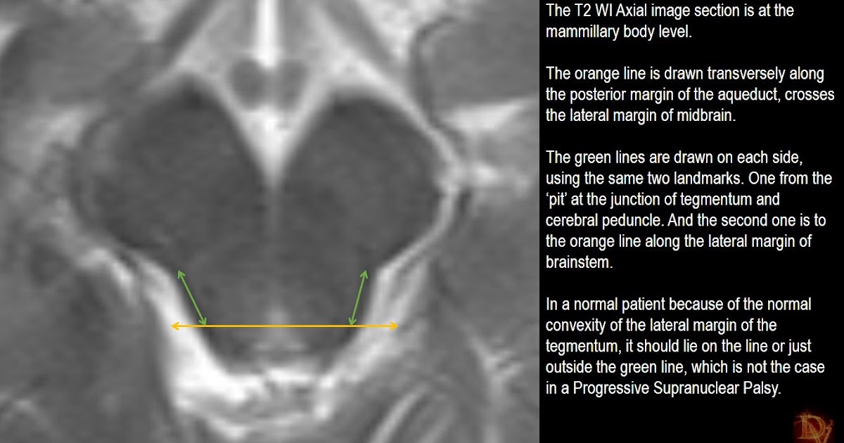 Ultimate Radiology 'Hummingbird and Morning Glory' of Radiology