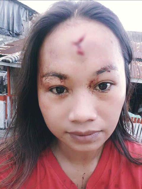 Sadis Gara-gara Gengsi Jadi Penganguran, Suami Bacok Istri Sendiri Sadis Gara-gara Gengsi Jadi Penganguran, Suami Bacok Istri Sendiri