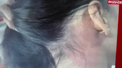 Marcas de agressão a Lúcia Garcia Marcas de agressão a Lúcia Garcia