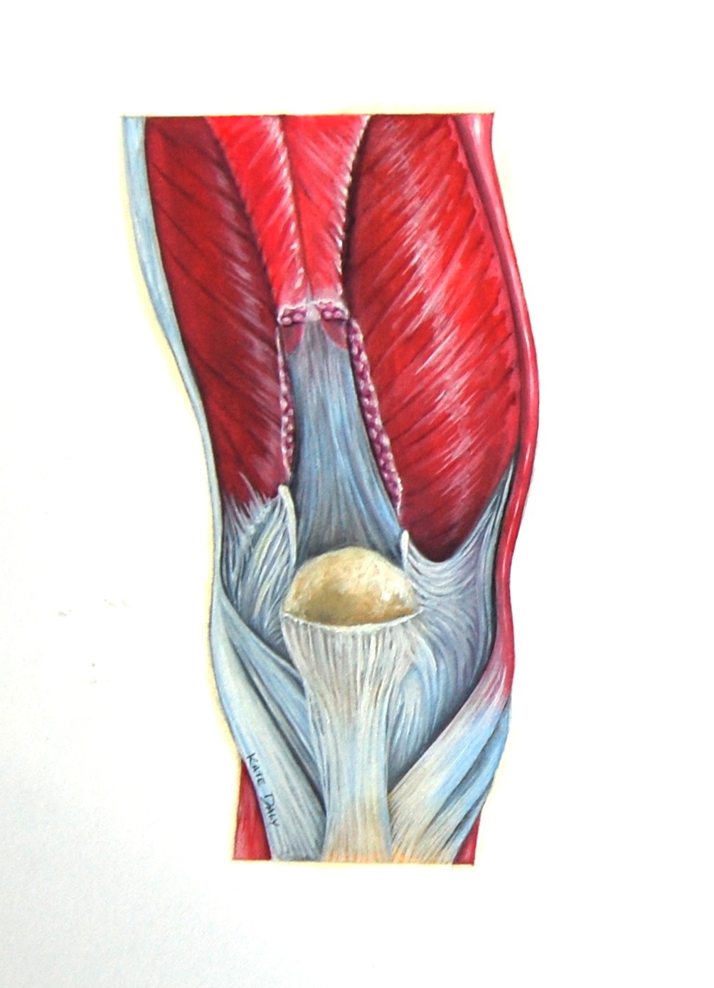 Kate Daly Medical Illustration Illustration of Quadriceps Tendon Repair