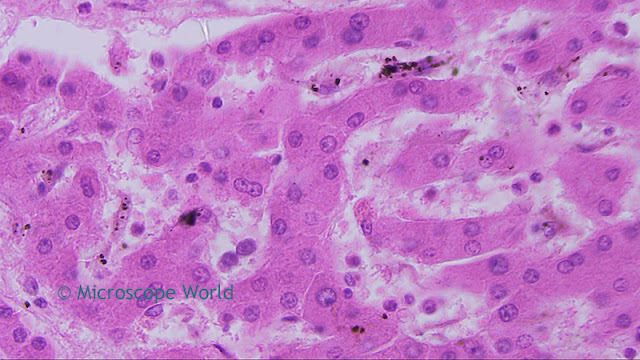 Cirrhosis of the liver captured at 400x by Microscope World.
